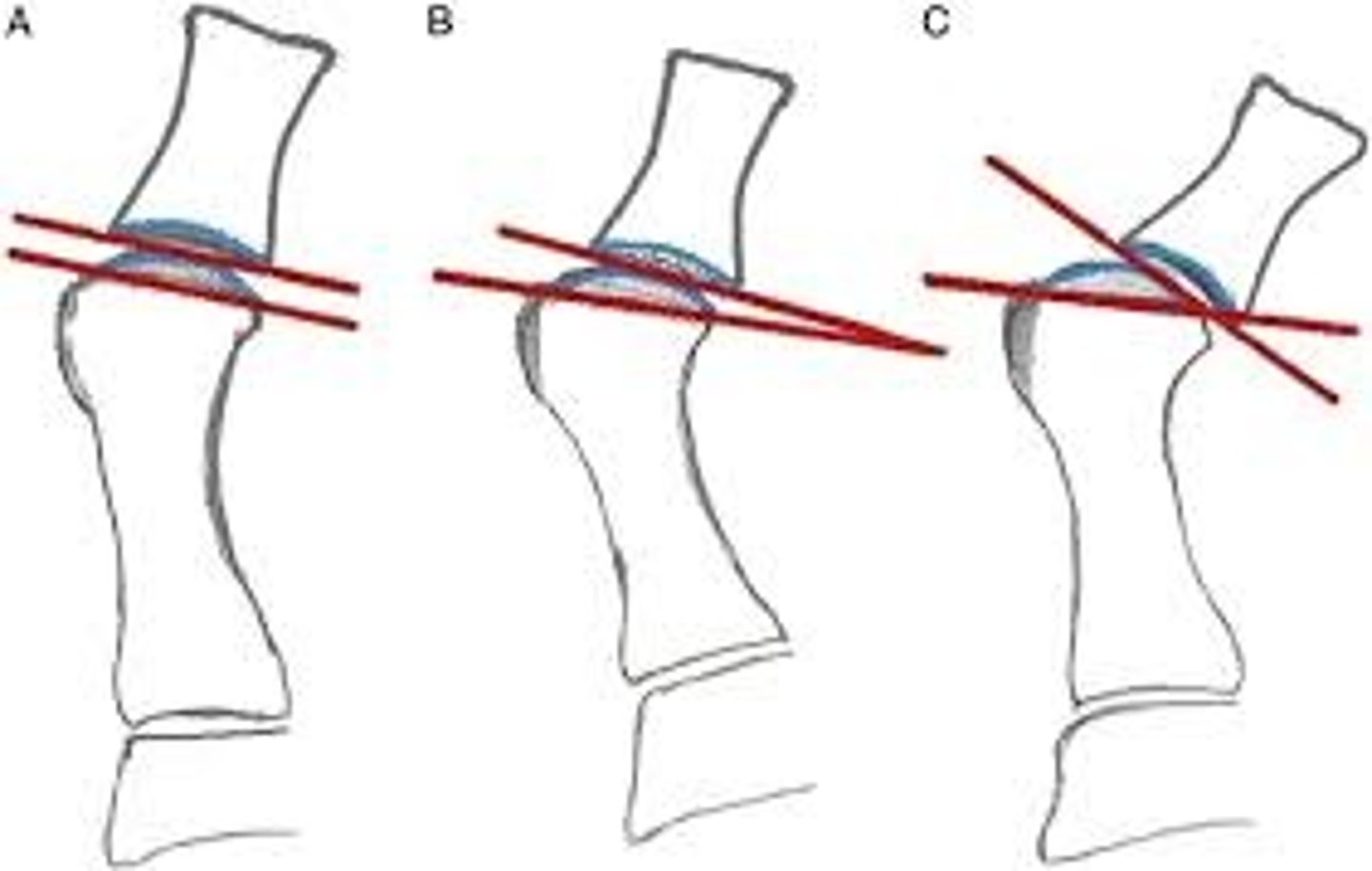 <p>v.越轨,脱离</p>