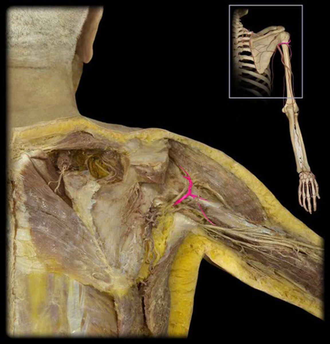 <p>Travels through quadrangular space w/ axillary nerve</p>