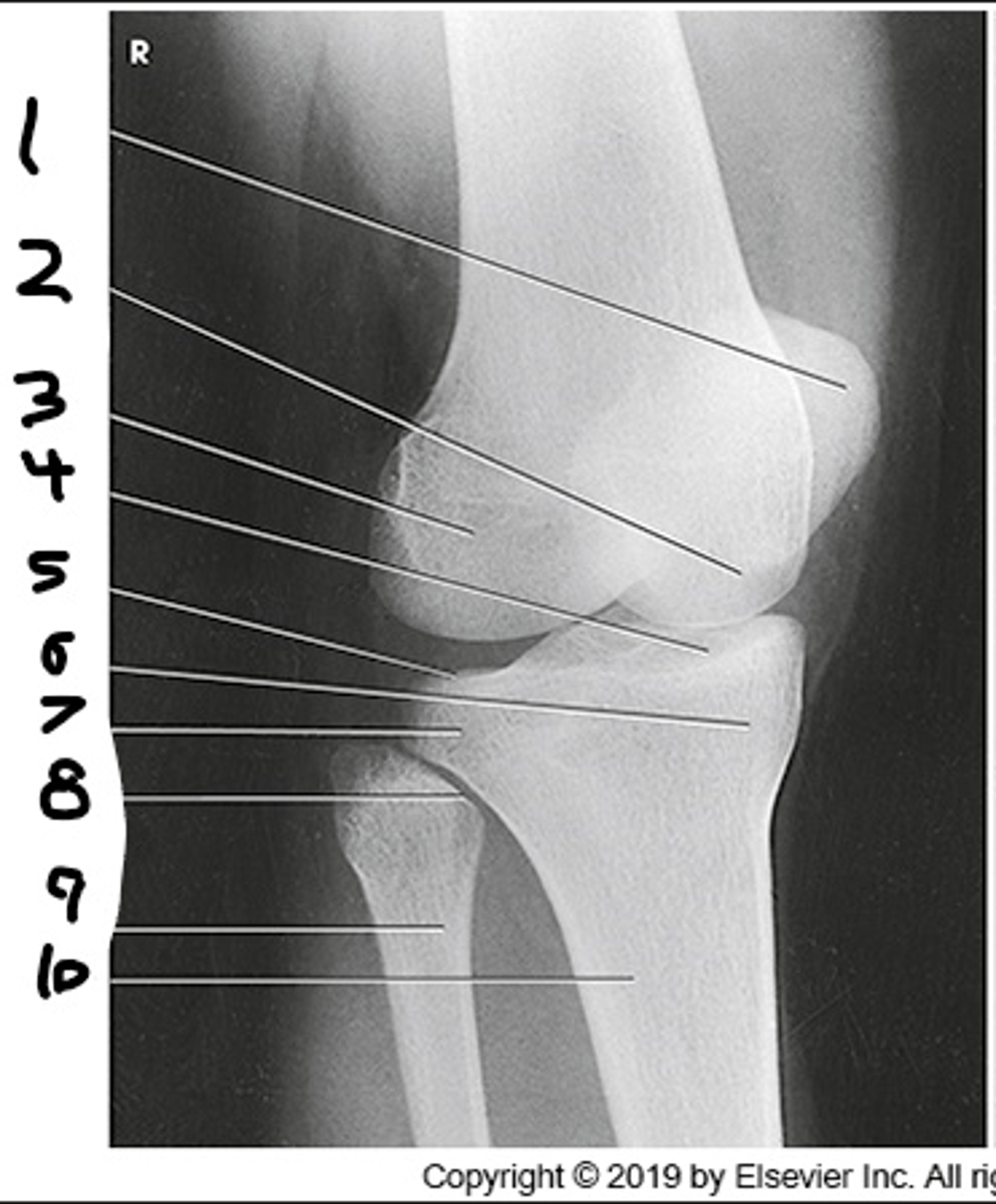 <p>head and neck of the fibula are visualized without superimposition</p><p>half of patella should be seen free of superimposition by the femur</p>