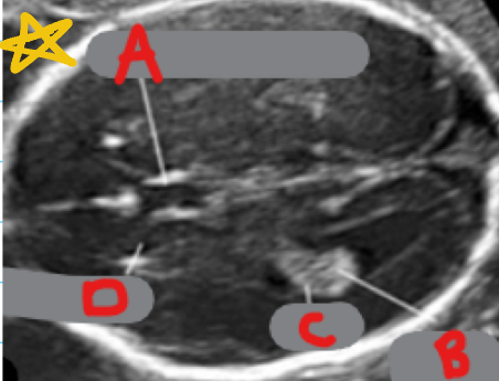 <p>What is labeled as A?</p>