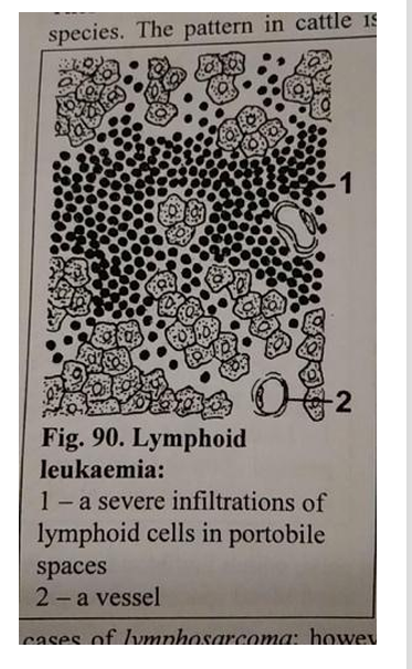 <p>Leucosis lymphadenoidea hepatis - lymphosarcoma</p><ul><li><p><em>one end of liver → basophilic stained tumor tissue formed by slightly differentiated lymphocytes</em></p></li></ul><img src="https://knowt-user-attachments.s3.amazonaws.com/6fb678be-5eb8-4d9e-b3bc-6033d4a9c568.png" data-width="100%" data-align="center"><p></p>