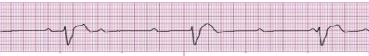 <p>What’s the rhythm?</p>
