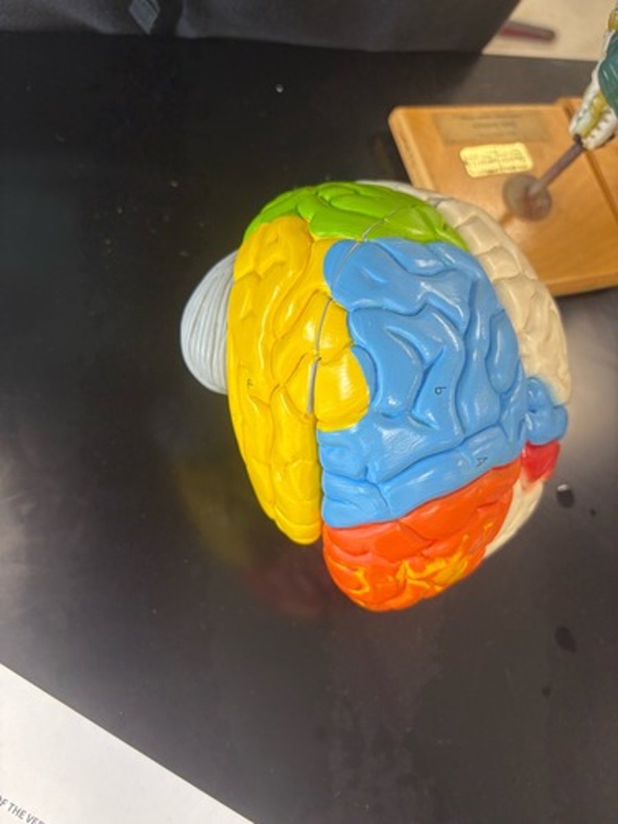 <p>Whole brain</p>