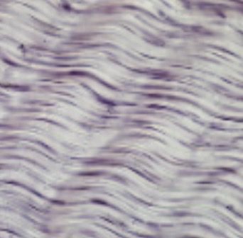 <p><strong>-parallel</strong></p><p>-made of collagenous fibers</p><p><strong>function</strong> → <span>provides </span><strong><span>strength</span></strong><span> &</span><strong><span> resistance to stretching in a single direction</span></strong></p>