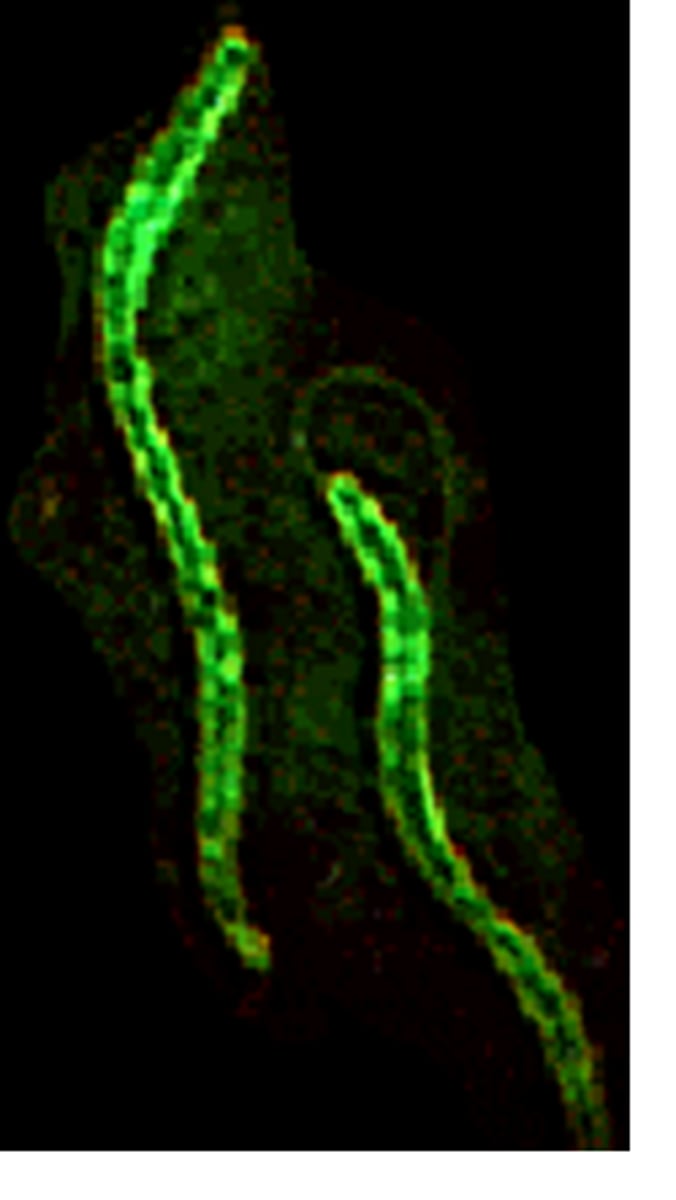 <p>-rigid corkscrew shape</p><p>-whip-like flagella at cell ends</p>