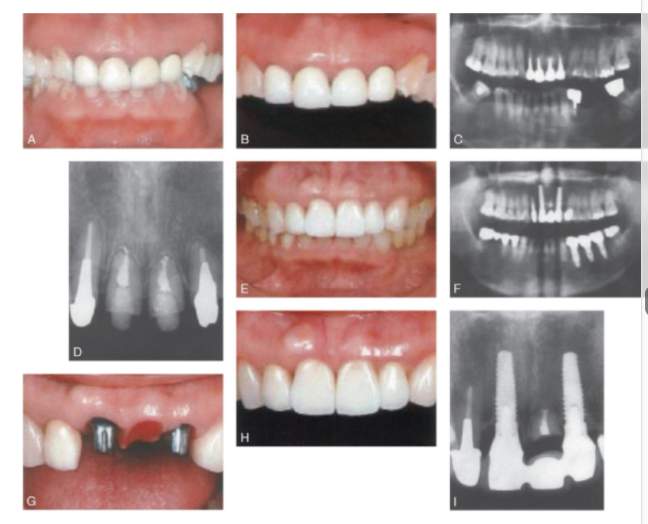 <p>root submergence techniques </p>