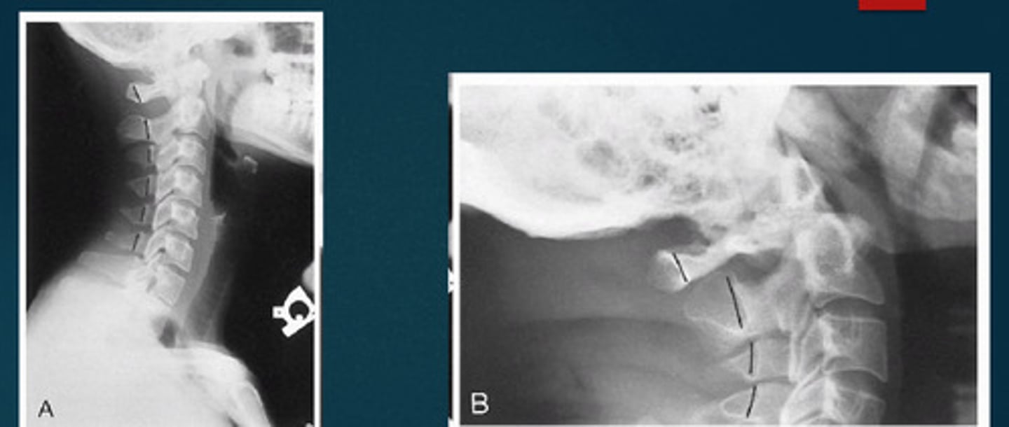 <p>What line of mensuration is this?</p>