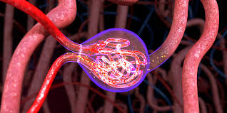 <p><strong>A female client with suspected glomerular disease has been referred to a nephrologist. The nurse knows that which of the following clinical manifestations may be present with the diagnosis of acute nephritic syndrome? Select all that apply.</strong></p><p>A) Sudden onset of hematuria</p><p>B) Proteinuria</p><p>C) Flank pain</p><p>D) Excess urine output</p><p>E) Edema</p>