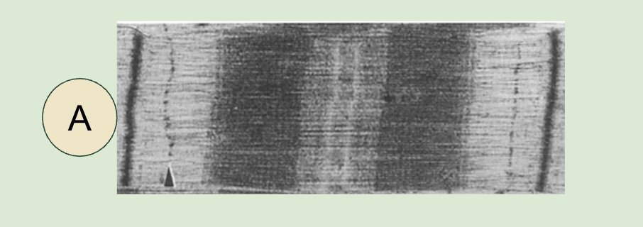<p>Micrograph of Relaxed Sacromere </p>