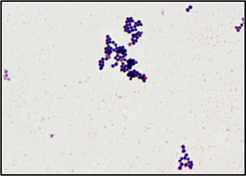 <p>P = purple = postive</p>