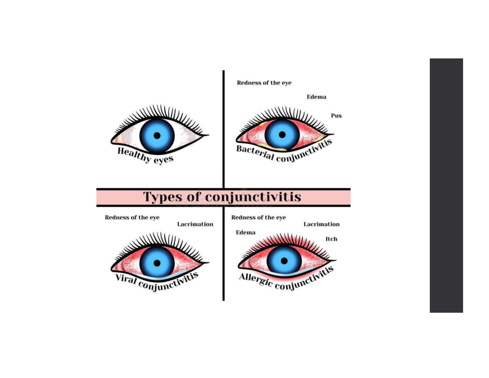 <p>Uncontrolled growth of abnormal cells in the body that can invade other tissues.</p>