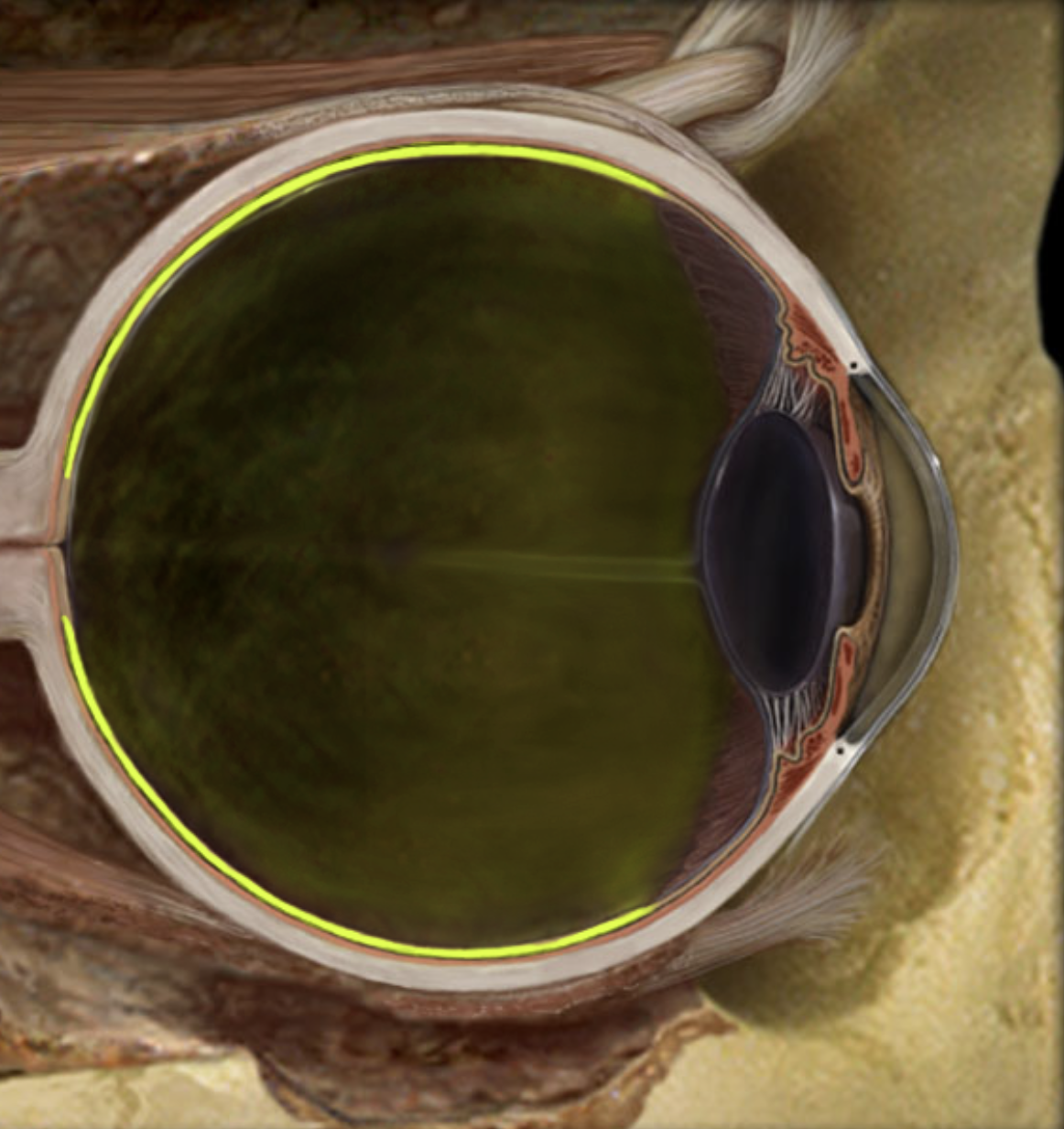 term image