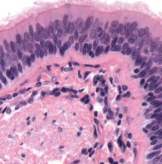 <p>identify the mucus membrane </p>