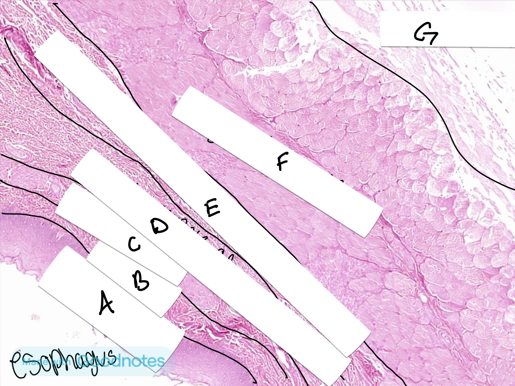 <p>What is labeled B on this organ</p>