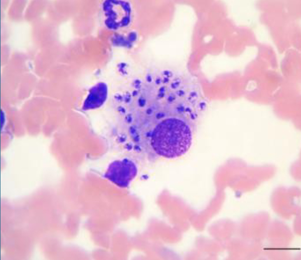 <p>Skin scraping of cutaneous lesions of lymph nodes, spleen, bone marrow, or other tissues</p>