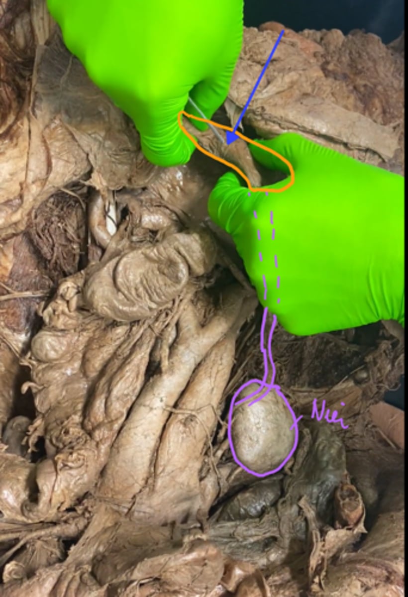 <p>urineblaas</p>