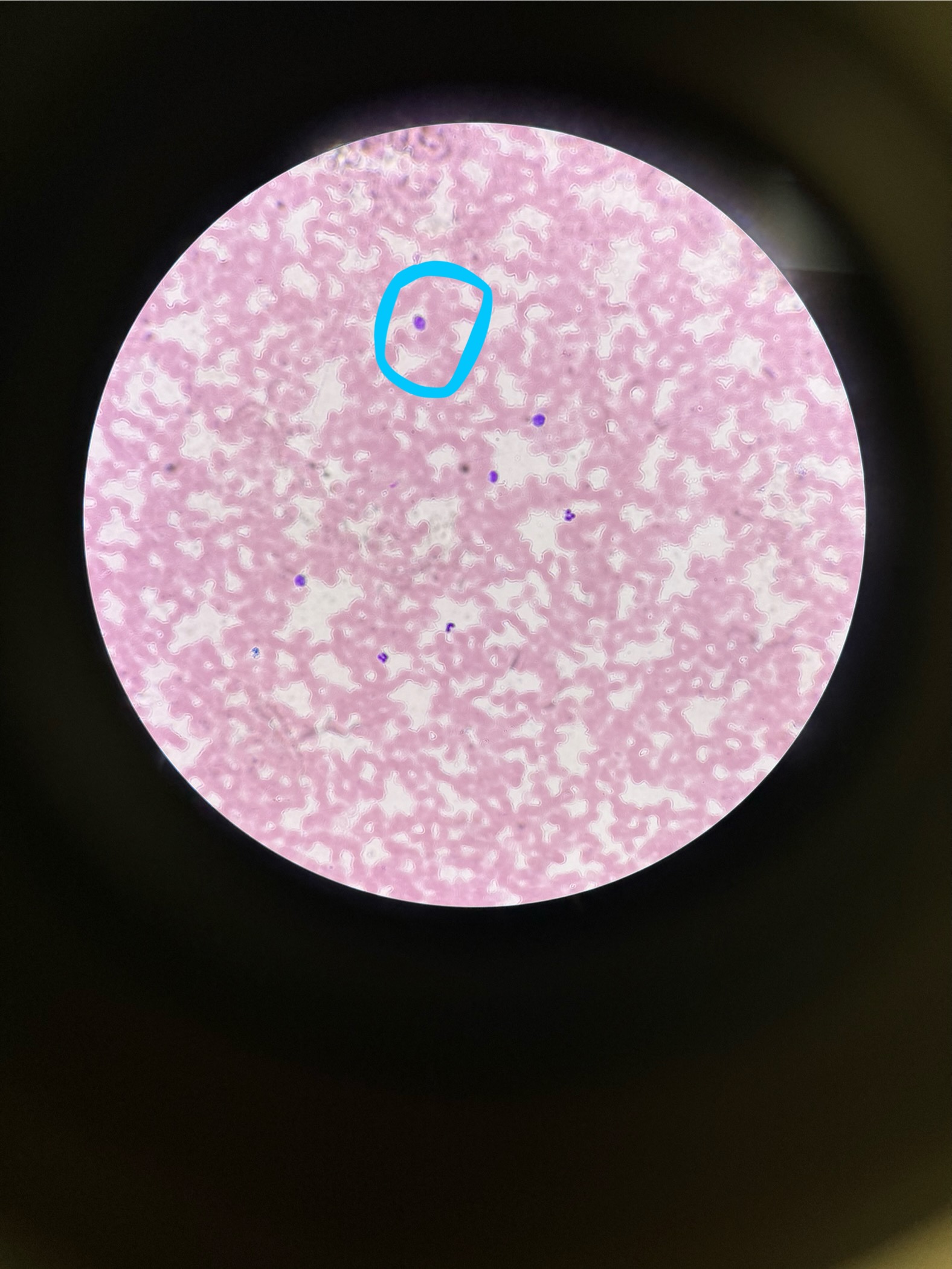 <p>What is being circled (view closely)?</p>