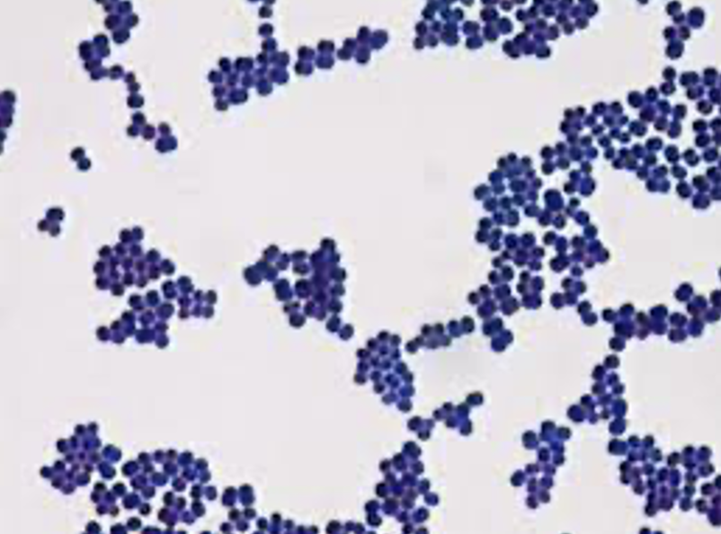 IDENTIFY THE BACTERIA.