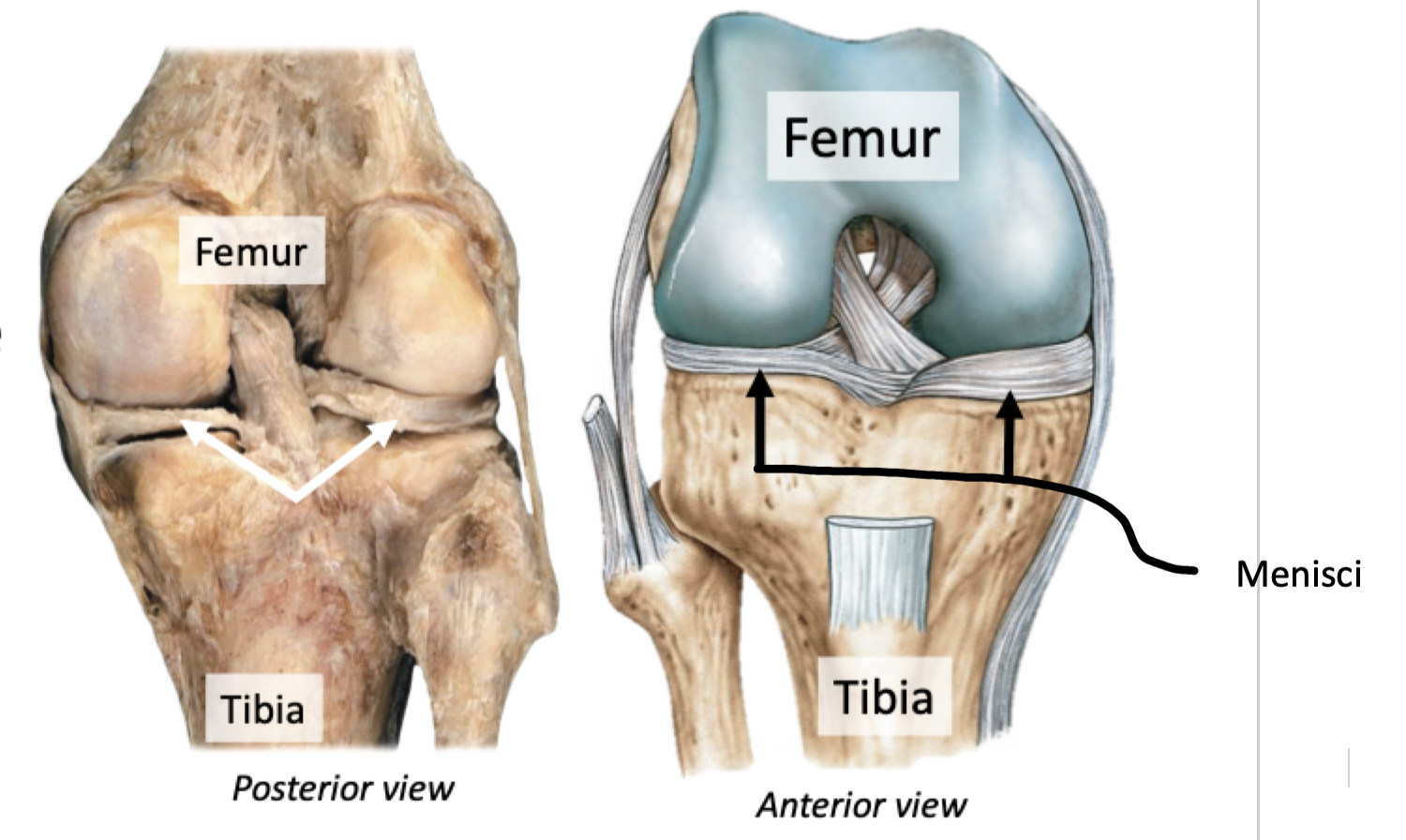 <p><strong>Menisci (meniscus)</strong></p><ul><li><p>Fibrocartilage pads between bone</p></li><li><p>Reduce friction, disperse weight, protect &amp; cushion joint surface</p></li></ul>