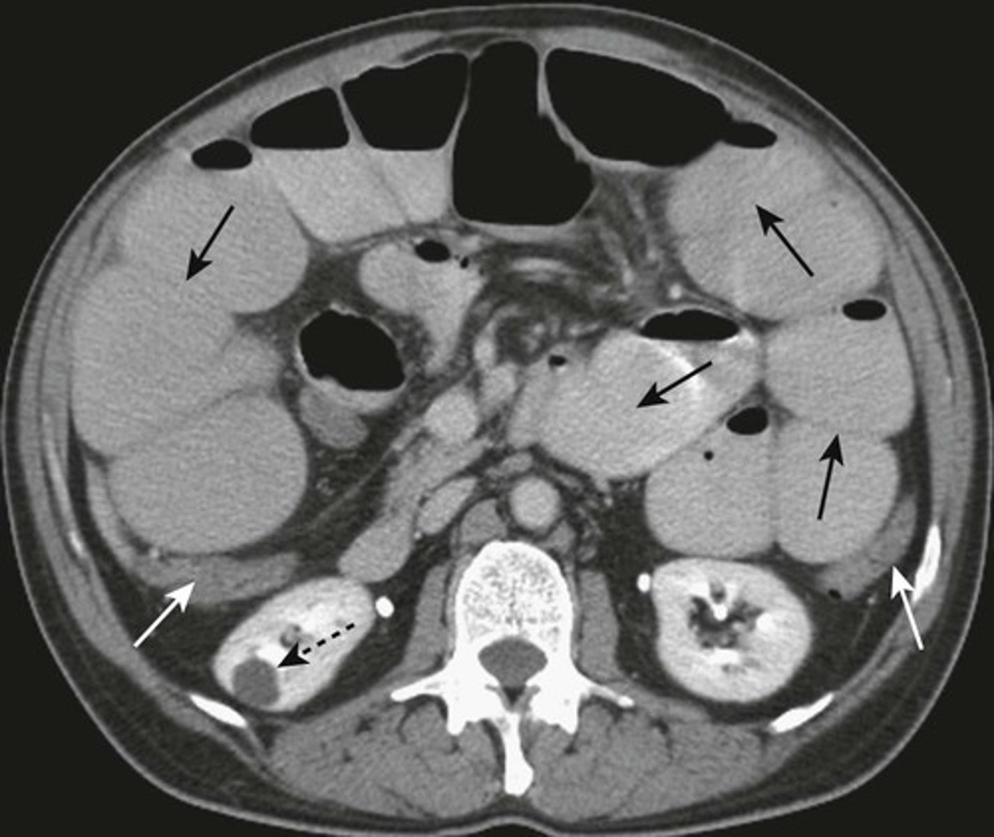 knowt flashcard image