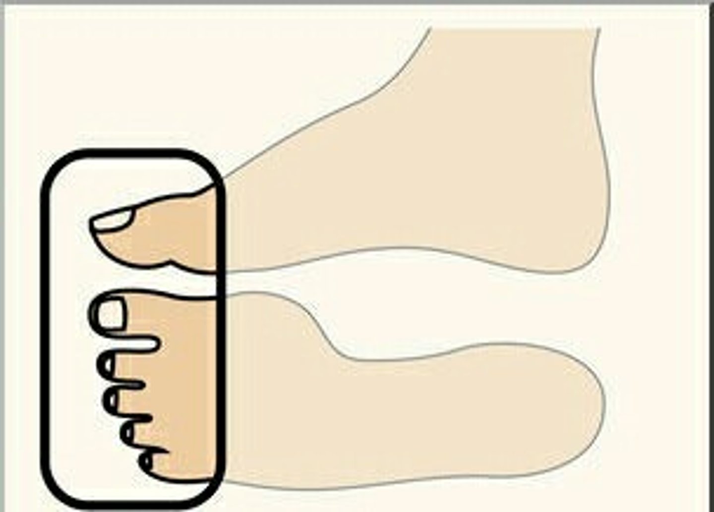<p>toes</p>