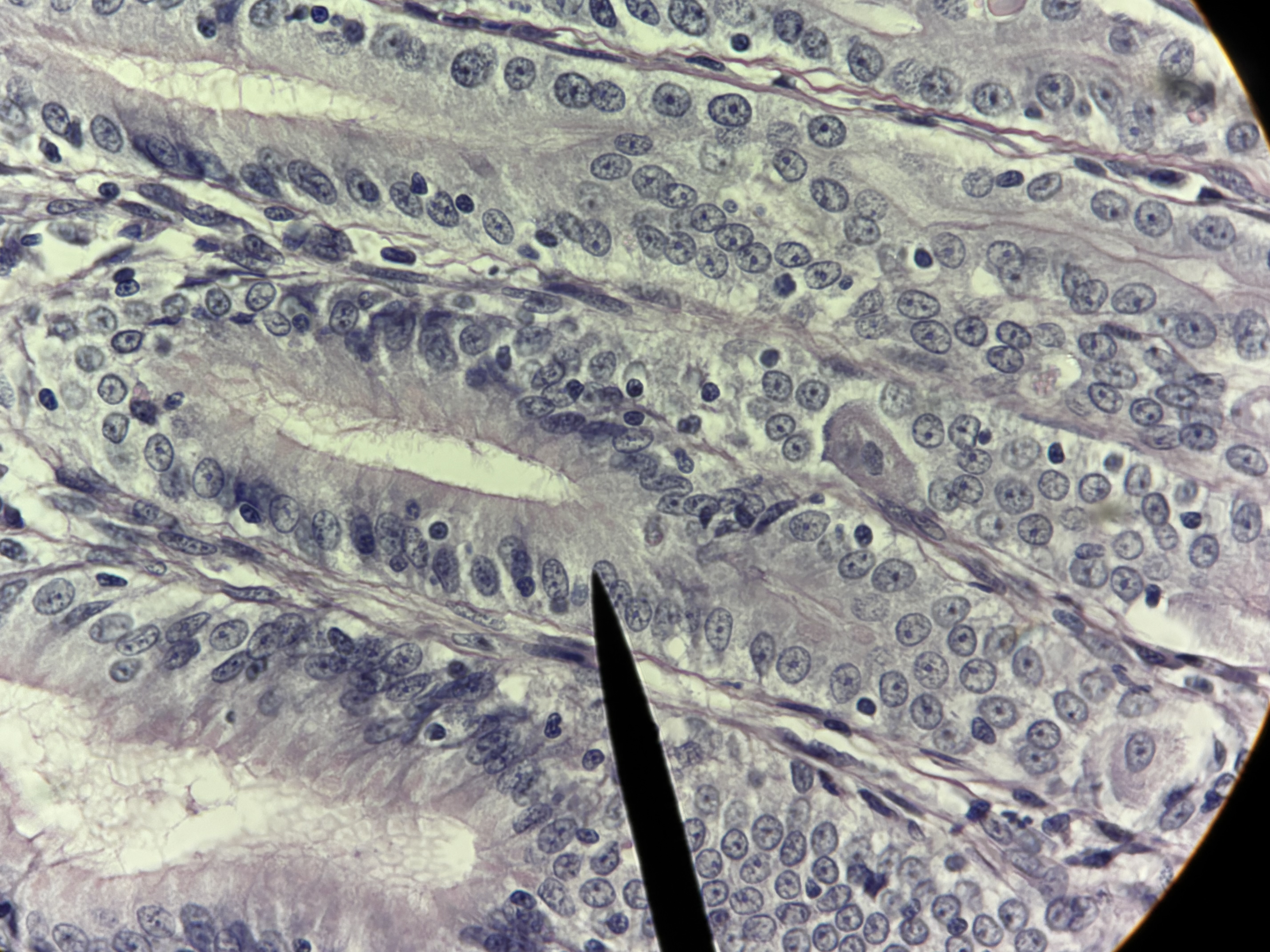 <p><span>Simple Columnar ET</span></p>