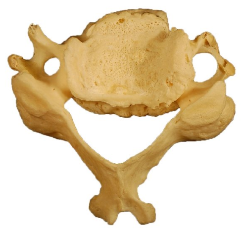 <p>What kind of vertebrae is this?</p>