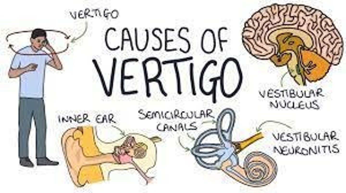 <p>A sensation of instability or loss of equilibrium, often due to inner ear disturbances.</p>