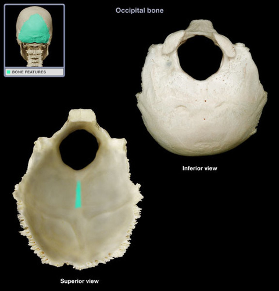 <p>inferior arm of the cruciform eminence</p>