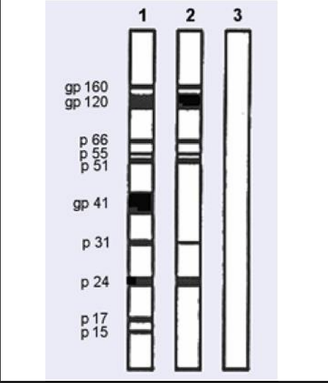 <p>if at least 2 of the major antigens are present (p24, gp41, gp 120/160)</p>