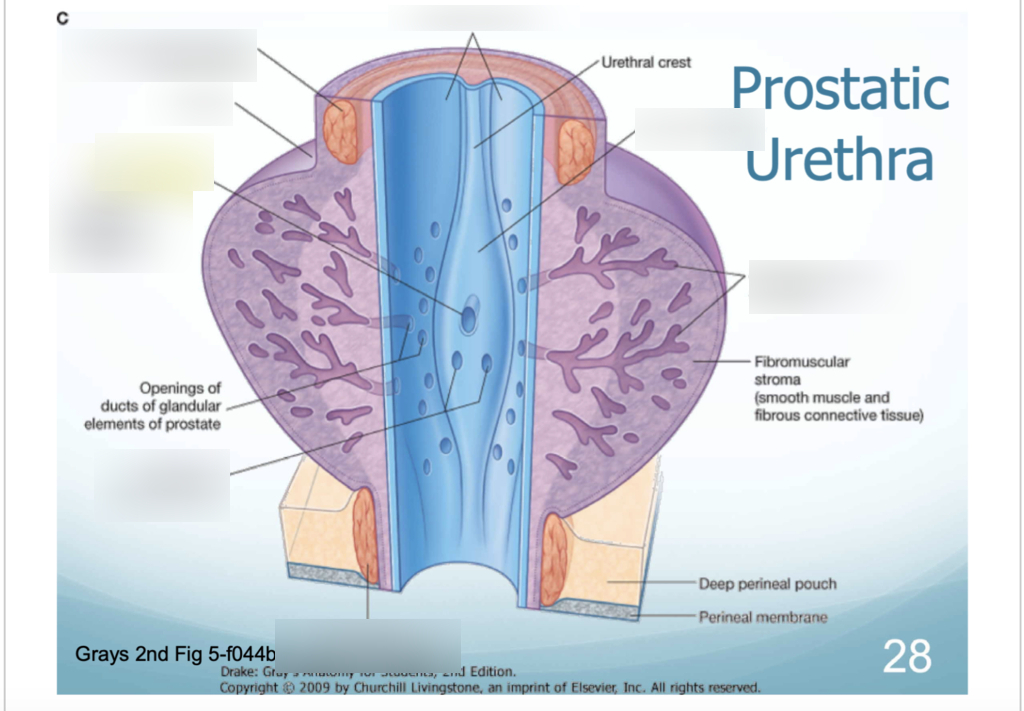 <p>A. encircles the urethra</p><p><strong>prostate gland</strong> surrounds the <strong>prostatic urethra</strong></p><p>is <strong>extraperitoneal</strong></p><ul><li><p>prostate is <strong>not well visualized by intravenous urogram (IVU)</strong>, which images the urinary tract via contrast excreted in urine</p></li><li><p>traditional anatomical description of the prostate divides it into <strong>zones (peripheral, central, transitional)</strong>, <u>not </u>into upper, middle, and lower lobes</p></li></ul><p></p>