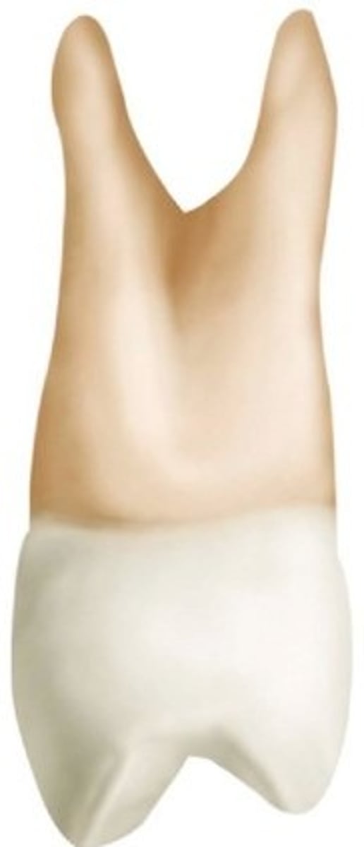 <p>Maxillary first premolar.</p>