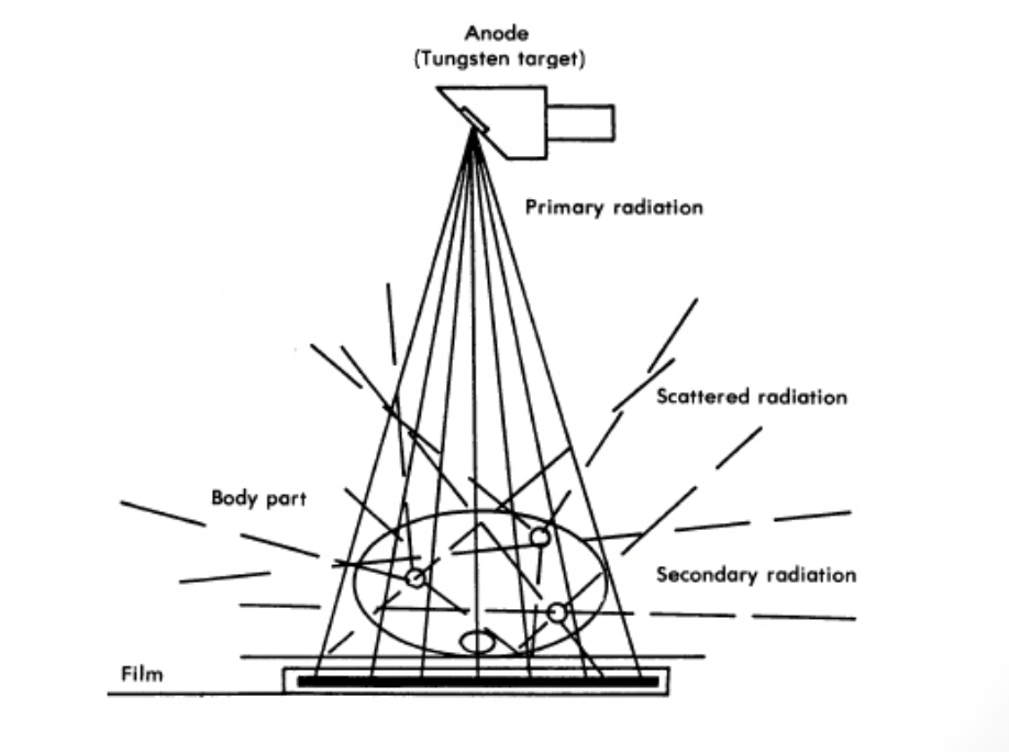 <p><strong>What happens as the primary beam passes through the patient?</strong></p>