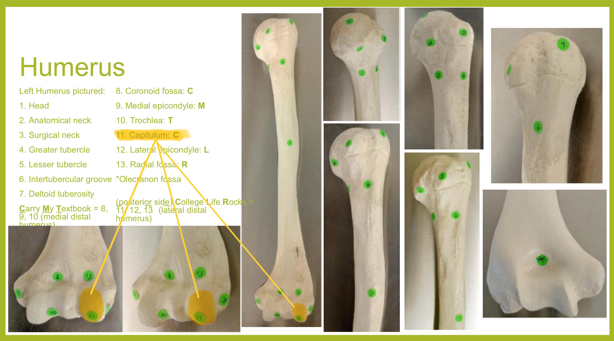 <p>capitulum (condyle) of humerus</p>