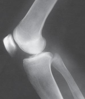 <p>Which knee projection is this </p>