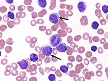 <p>lymphocytes</p>