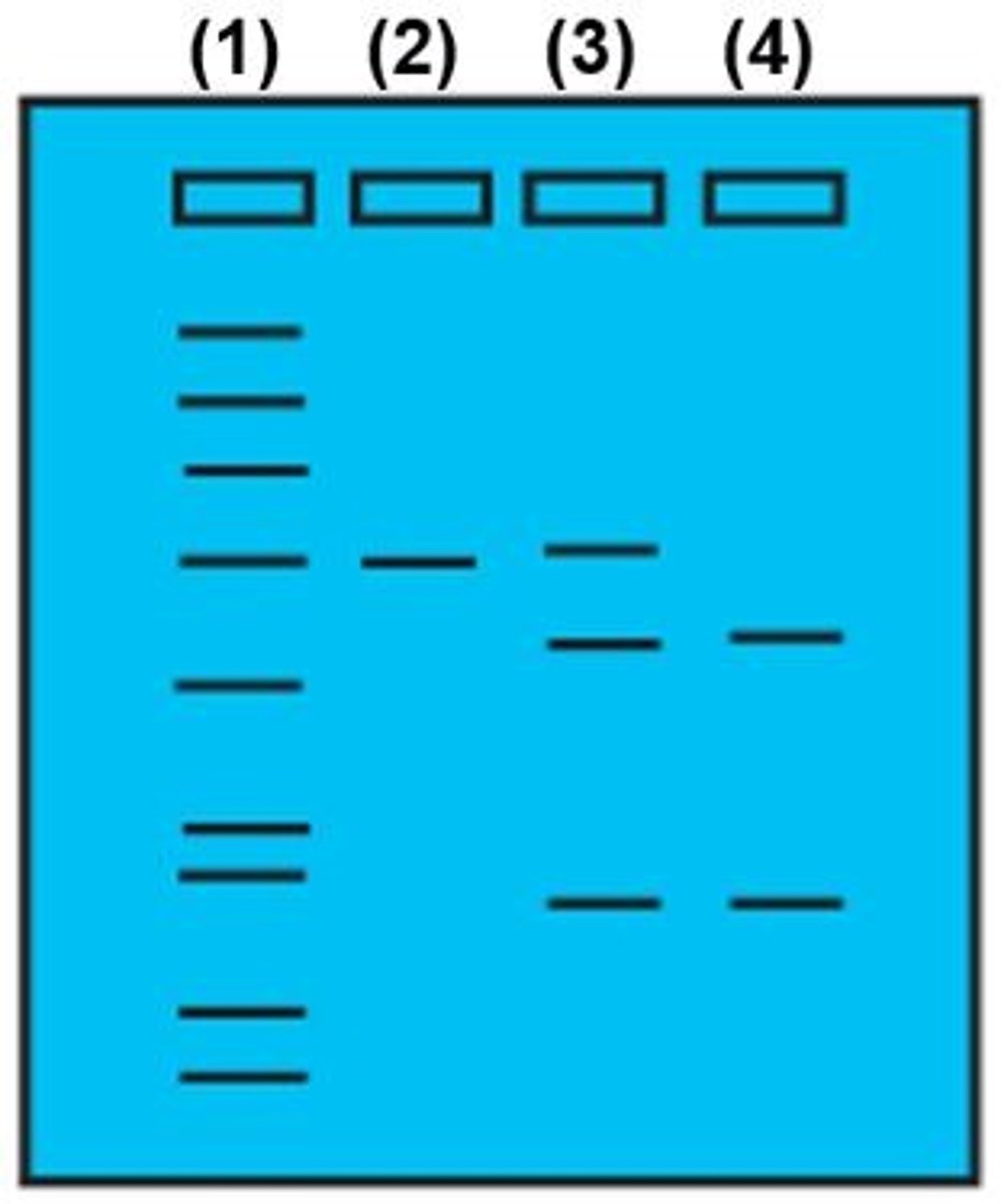 <p>Based on the gel, which of the following best describes the genetic makeup of patient number (4):</p><p>Homozygous normal</p><p>Homozygous for FH</p><p>Heterozygous for FH</p>