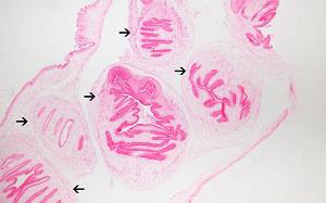 <p><strong>Identify this parasitic stage and its adult parasite.</strong></p><p><strong>Mention two morphological characteristics of this stage.</strong></p>