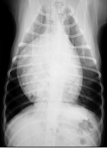 <p>What heart condition? </p><p>4 ddx? </p>