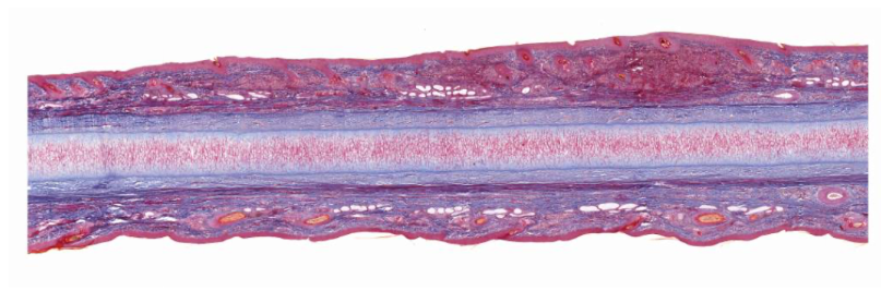 <p>Similar to hyaline but the matrix also contains a dense network of branching elastic fibres - occurs where flexibility is required e.g. epiglottis, external ear and auditory tubes.</p><p></p><p>Perichondrium (blue)- a dense layer of irregular connective tissue that surrounds cartilage - 2 layers</p><p>Inner Chondrogenic layer (dark blue)- contains mesenchymal cells that differentiate into chondroblasts, initiate matrix production (elastin and type 2 collagen) and become immature chondrocytes.</p><p>Outer fibrous layer (blue) - fibroblasts produce type 1 collagen on the outer surface of the perichondrium</p><p>matrix - fibroblasts that produce type 1 collagen on the outer surface.</p><p>chondrocytes - cells within lacunae inside cartilage that occur singularly or in clusters (isogenous groups)</p><p></p><p>No blood or nerves</p>