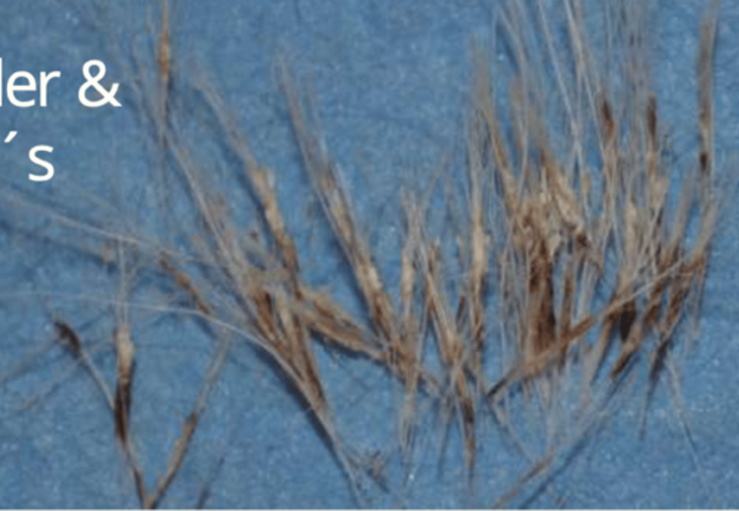 <p>¿lesión?</p><p>¿primaria o secundaria?</p>