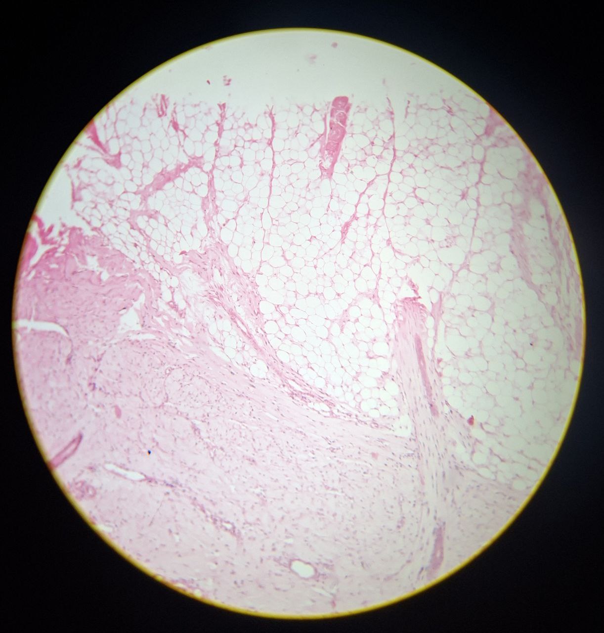 <p>Identify the tissue and mention one site</p>