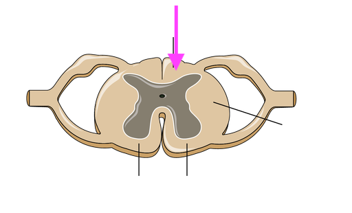 <p>What is this feature? is it grey matter or white?</p>