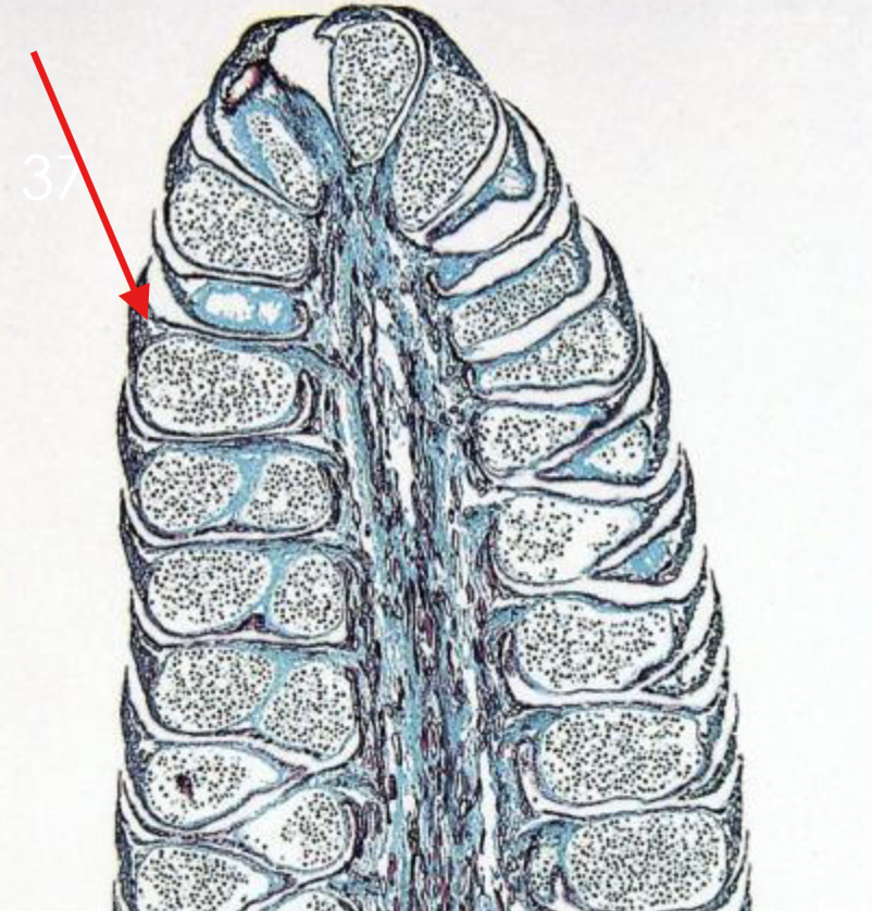 <p>What is being indicated on the Pinus Microstrobilus?</p>
