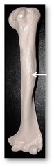 <p>for deltoid muscle, on humerus</p>