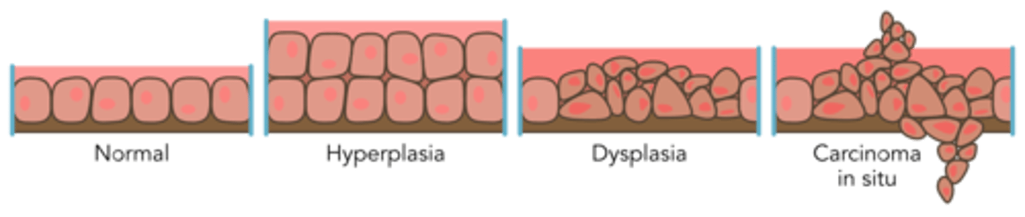 <p>- Changes/damage to cells</p><p>- Caused by Inherited traits, Errors in cell division, Environmental factors</p><p>- Effects of aging</p><p>- Cancers named by body part origin, cell type</p>