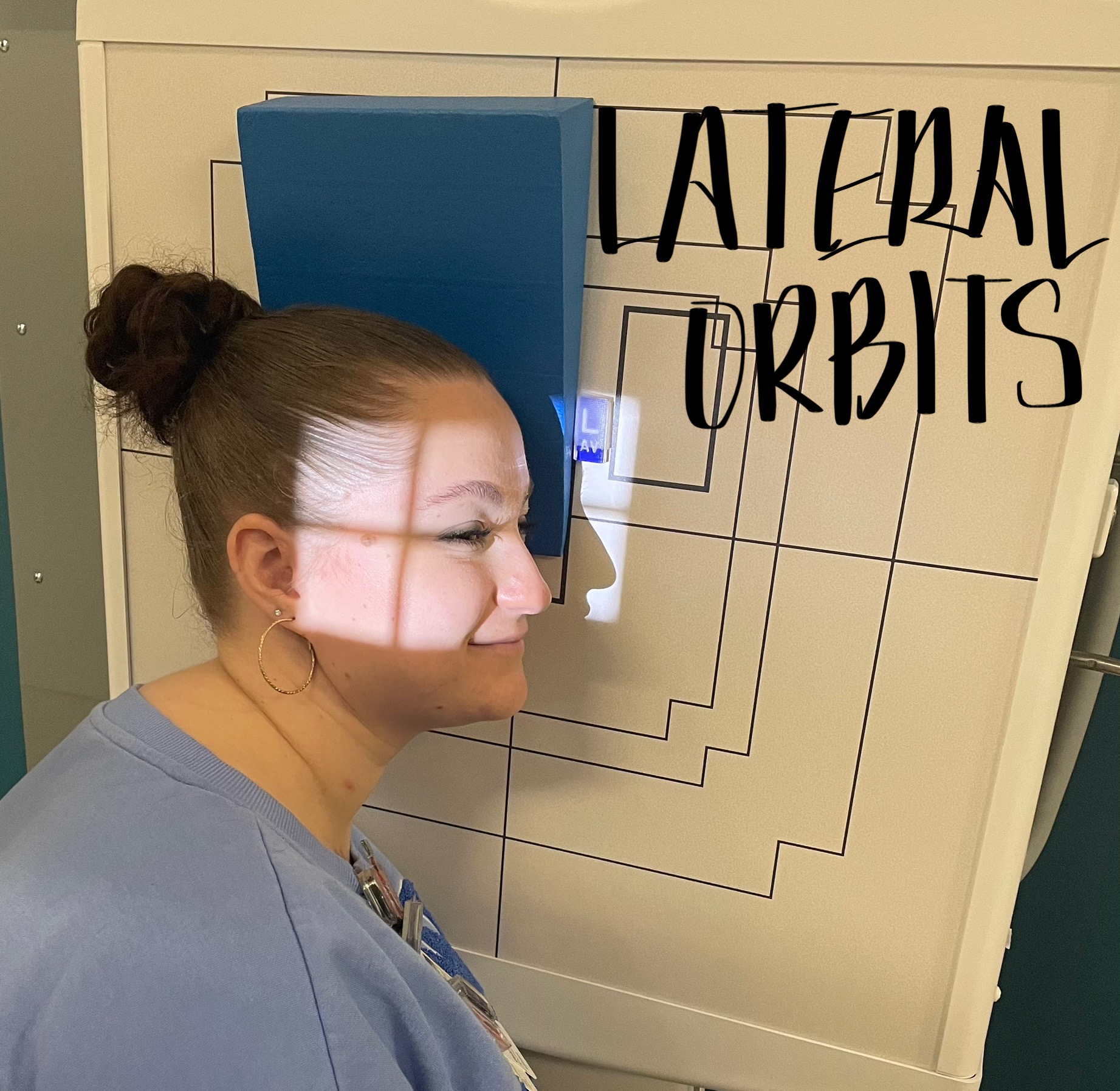 <p>Pt position: shoulders obliqued. Affected side of face lateral to the board. IOMBL horizontal to bottom of IR</p><p>CR entrance: outer canthus </p><p>tube angle: none</p><p>SID: 40”</p><p>Size IR : 10 × 12</p><p>Collimation: light ~ 1 “ anterior to EAM </p><p>Breathing: suspend</p><p>Anatomy: orbits and maxillary sinuses </p>