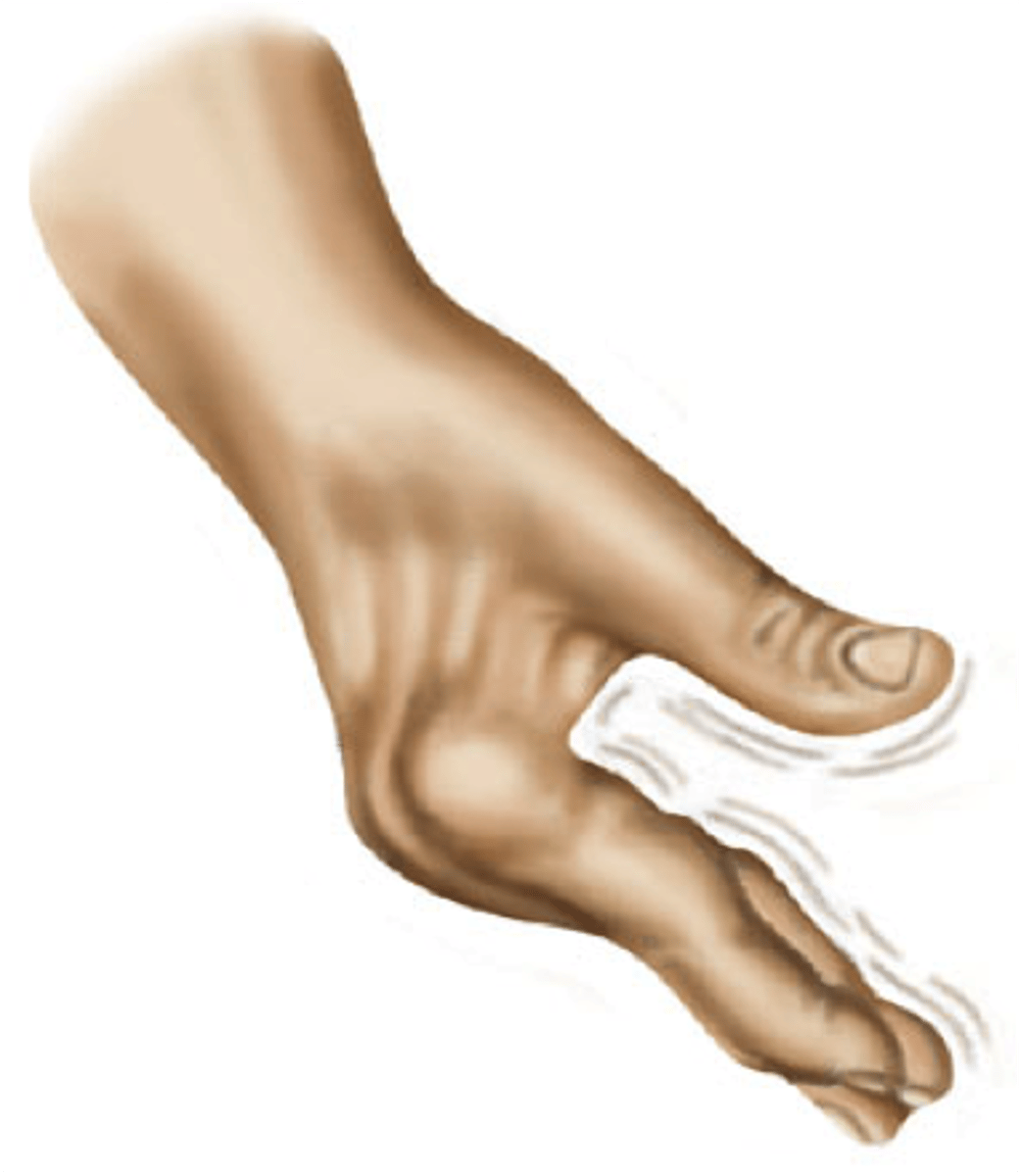 <p>a tremor that is apparent when the client is at rest and diminishes with activity</p>