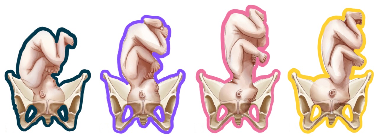 <p>pink presentation?</p>