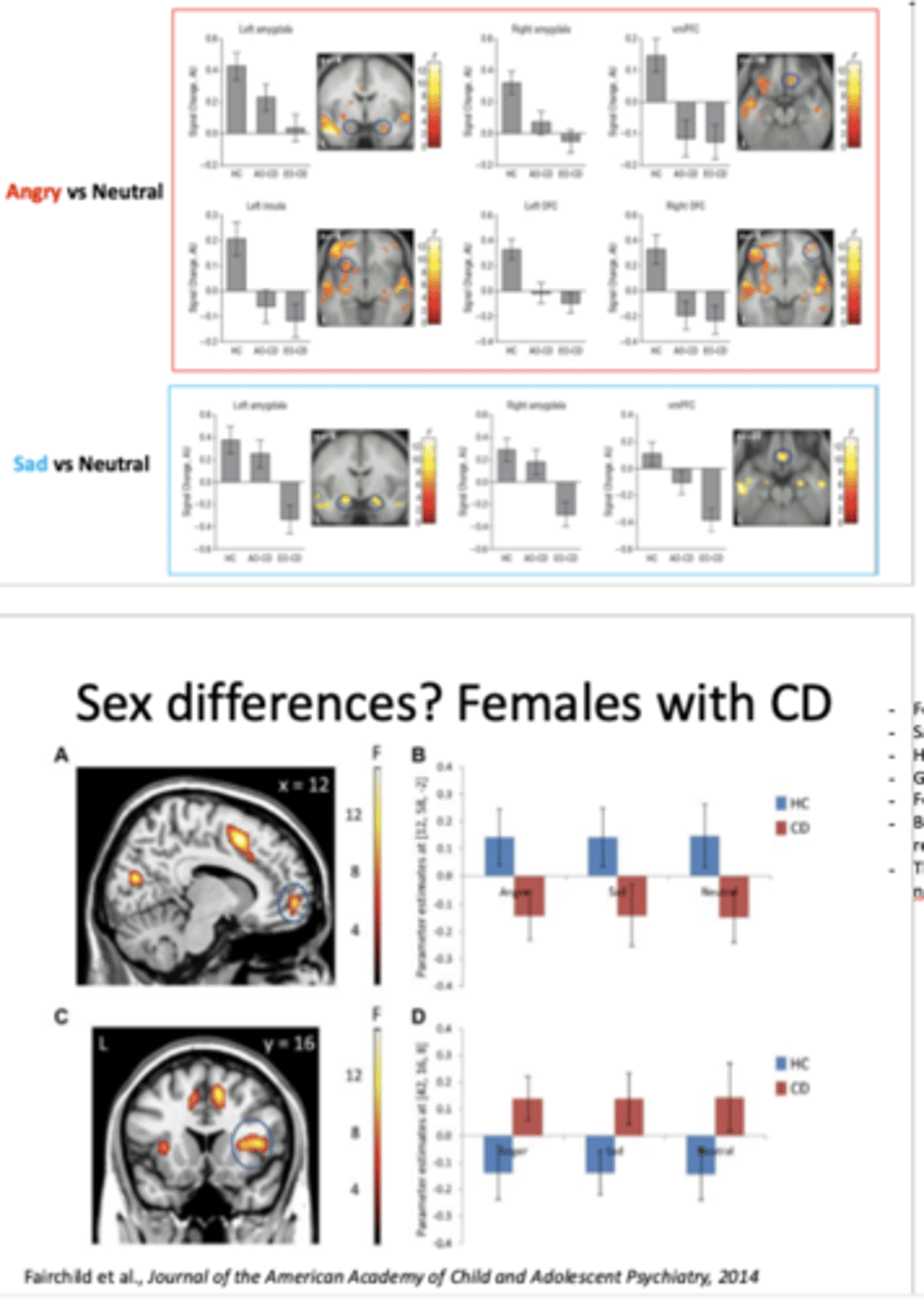 <p>Passamonti et al. (2010)</p><p>- male sample</p><p>- 3 conditions= sad faces, neutral faces, angry faces </p><p>- task= is the face of a male or female (implicit emotional processing)</p><p>- CD showed reduced response in amygdala, insula and vmPFC compared to controls (angry vs neutral condition)</p><p>- but when sad vs neutral condition, adolescence doesn't show differences but childhood onset do (less activation)</p><p>FOLLOW-UP study (Fairchild et al., 2014)</p><p>- female sample only</p><p>- females with CD show reduced responses across all facial expressions</p><p>- increased insula activity in fear condition (unlike males)</p><p>- biological sex is important to consider during neurcorrelates </p>